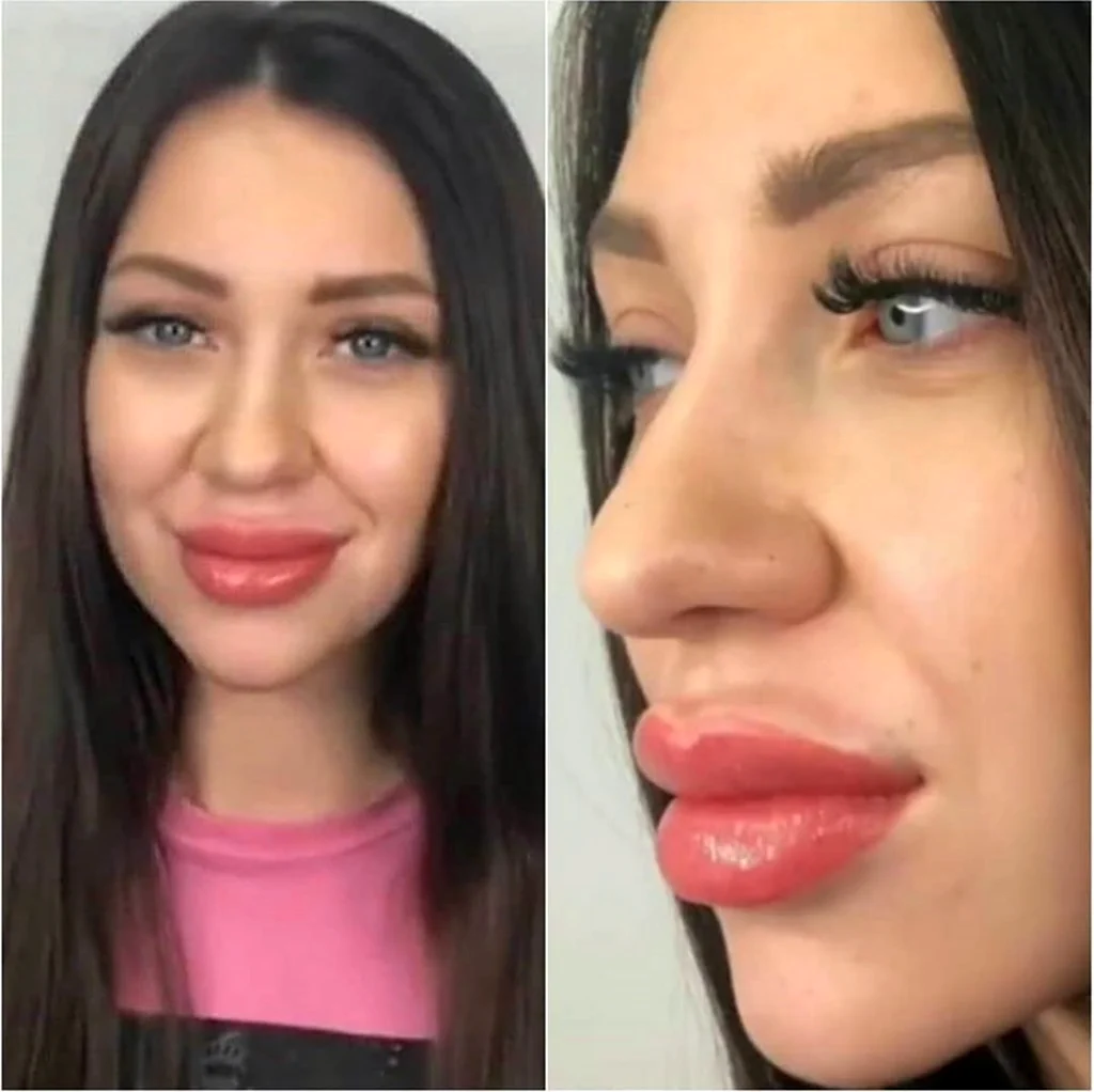 Алена Рапунцель губы