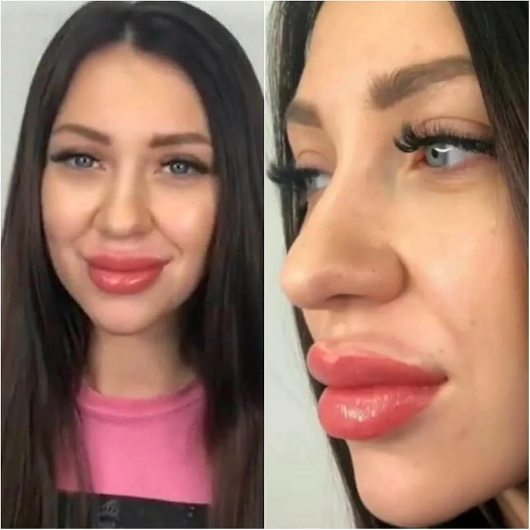 Алена Рапунцель губы