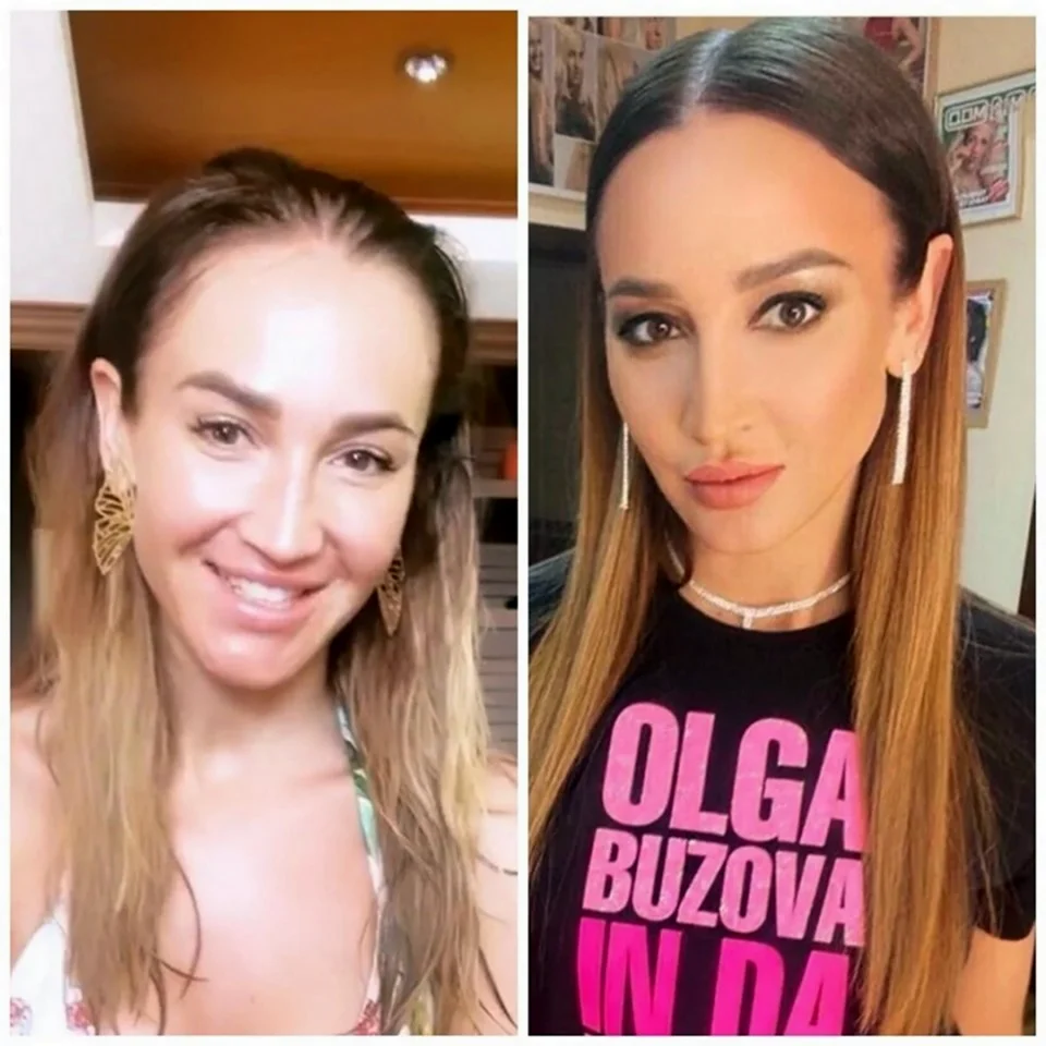 Анна Асти пластика