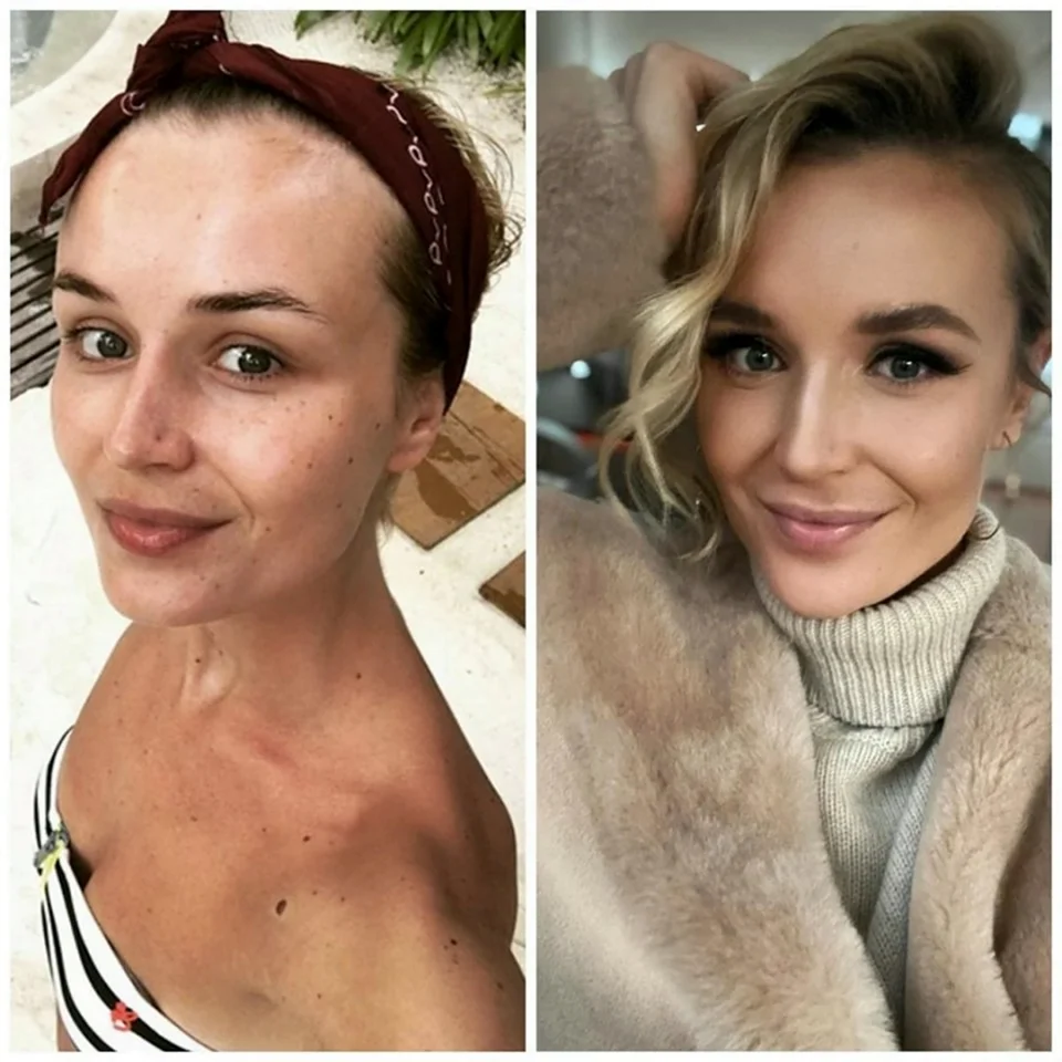 Анна Дзюба