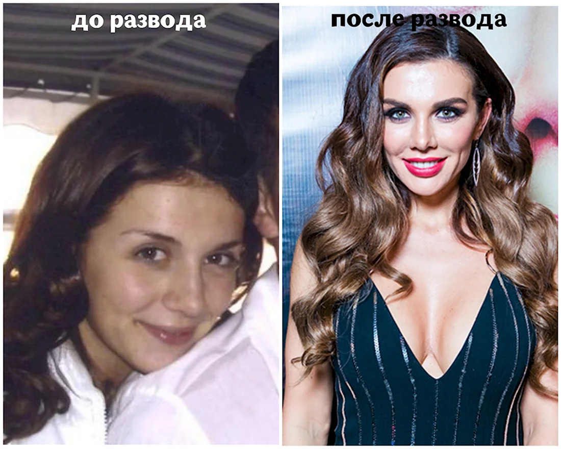 Анна Седокова до и после
