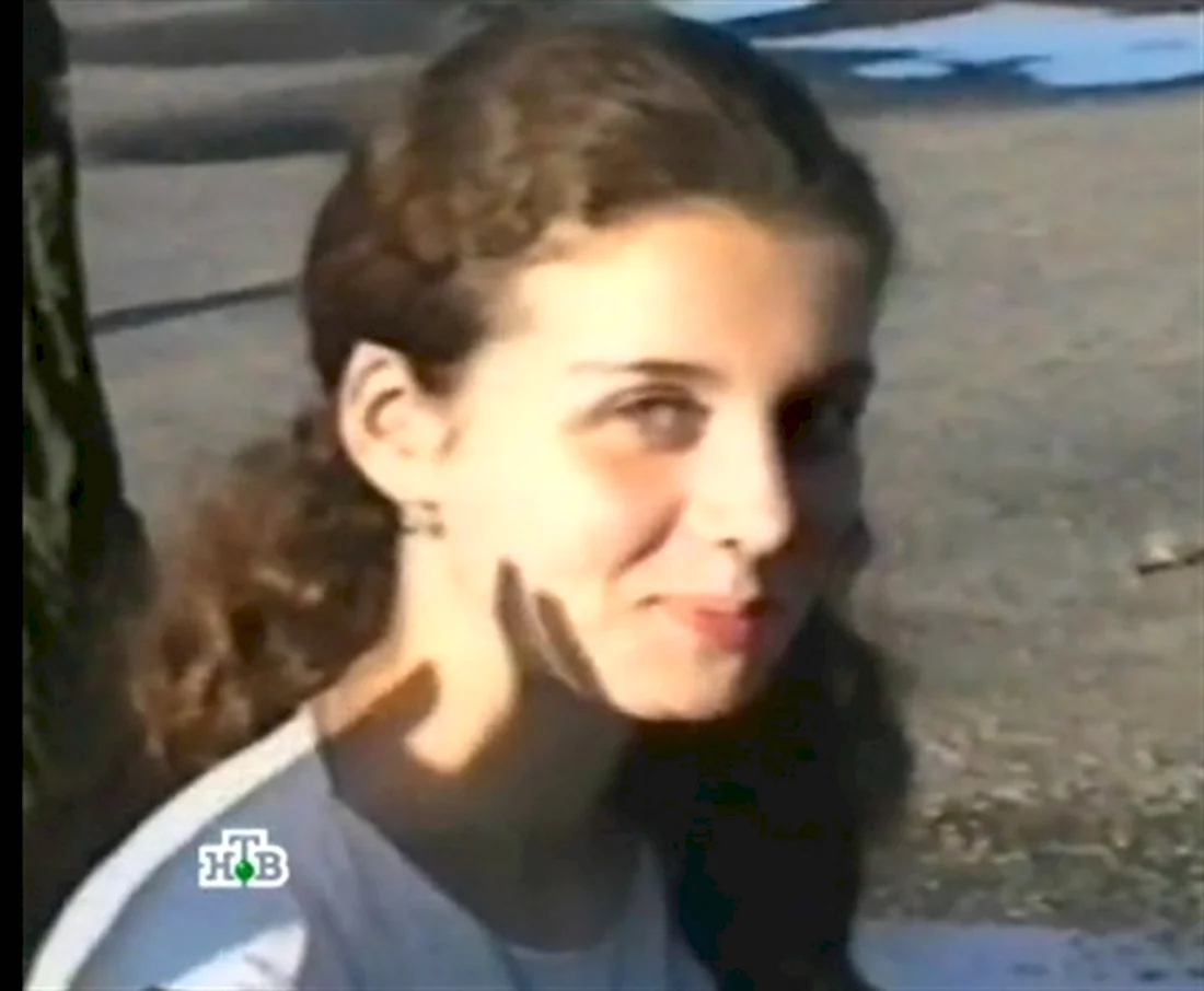 Анна Седокова фото до операций