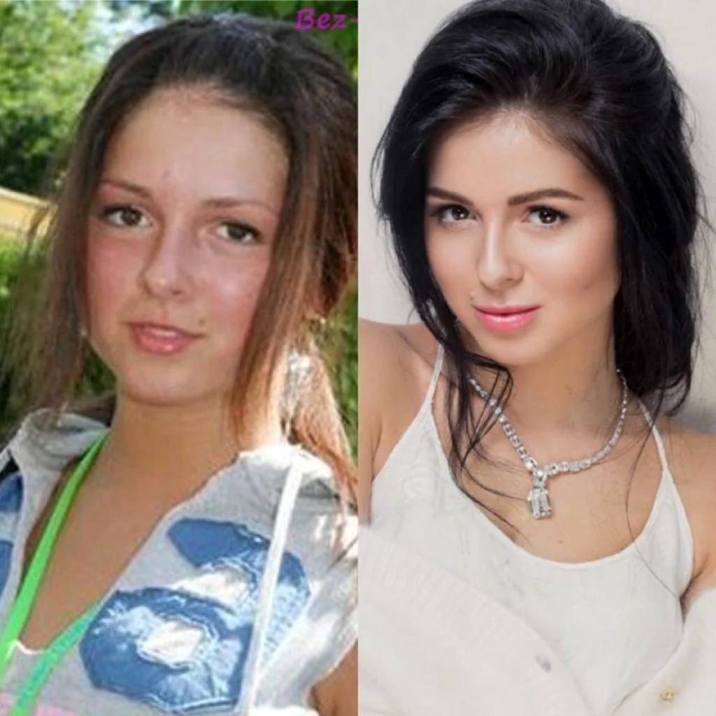Эда Илдыз актриса до пластики