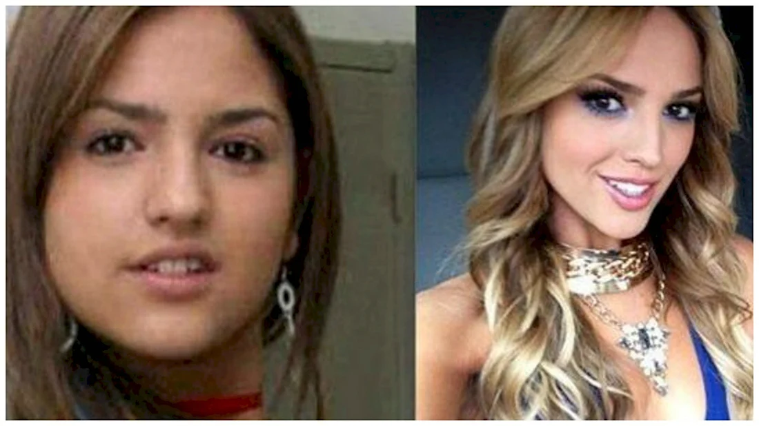 Eiza Gonzalez до пластики