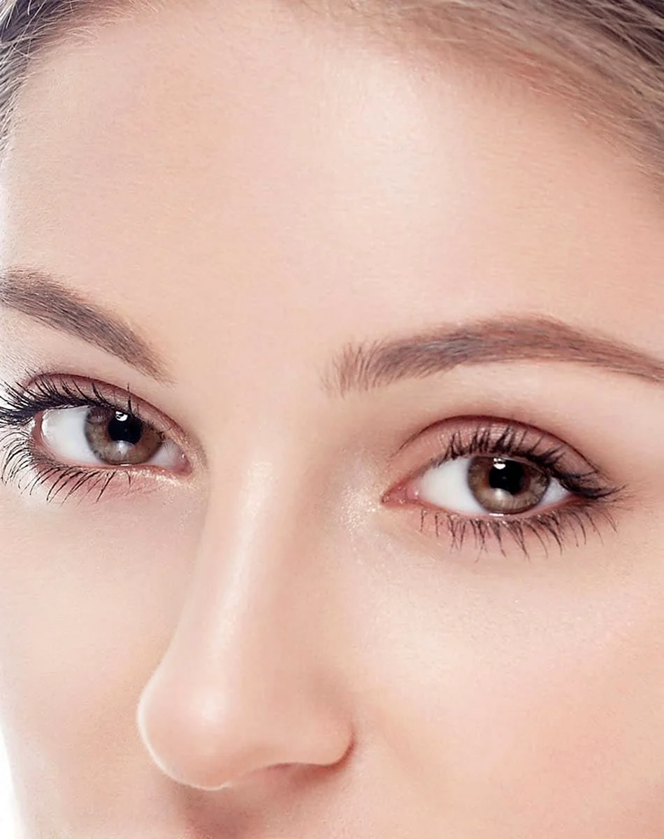 Filler under the Eyes