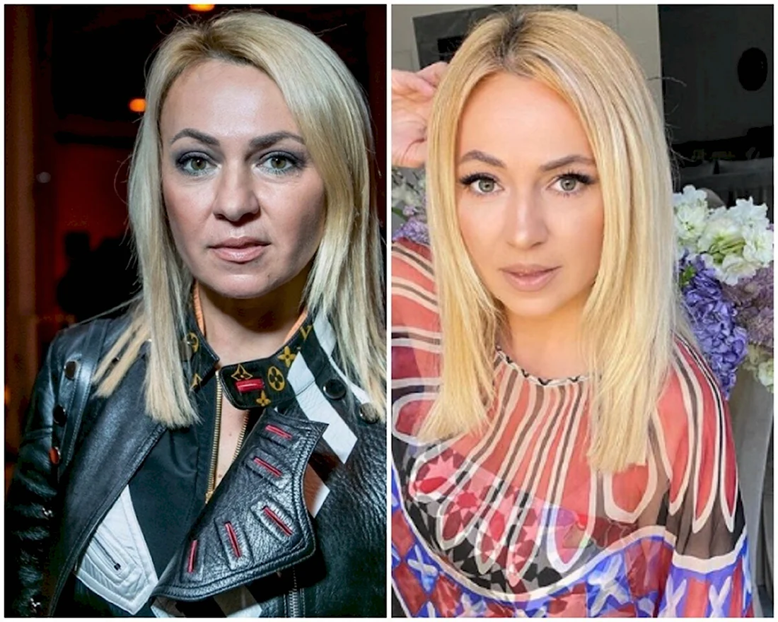 Яна Рудковская пластика 2020