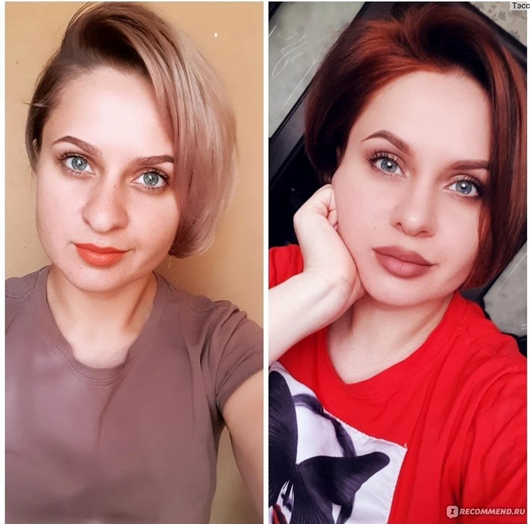 Кристина Шелест ринопластика