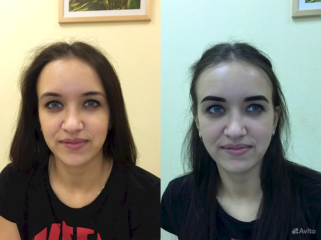 Ламинирование и ботокс бровей до и после