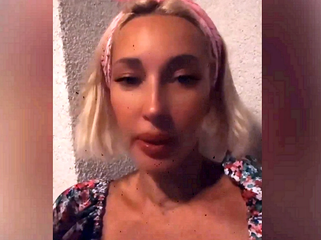 Лера Кудрявцева ринопластика