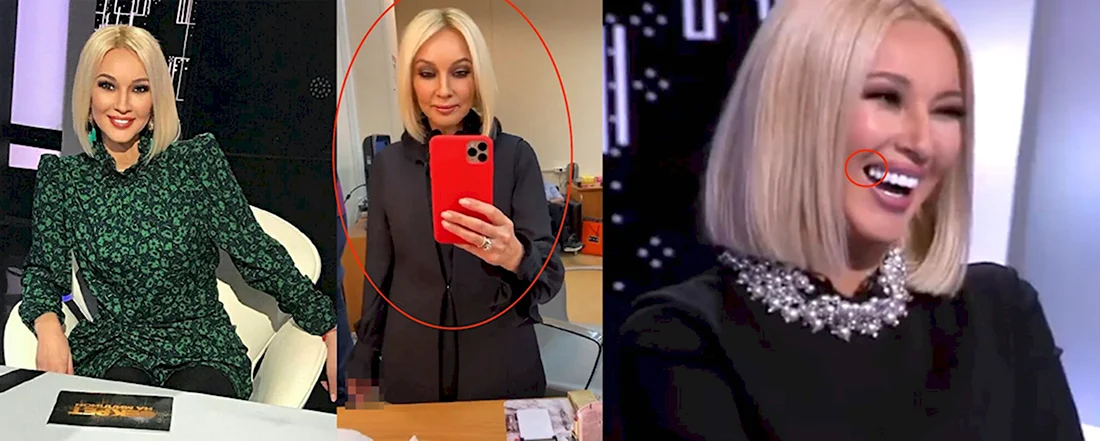 Лера Кудрявцева зубы