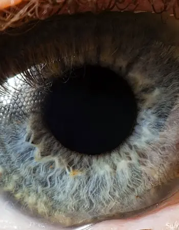 Макросъемка Радужки глаза
