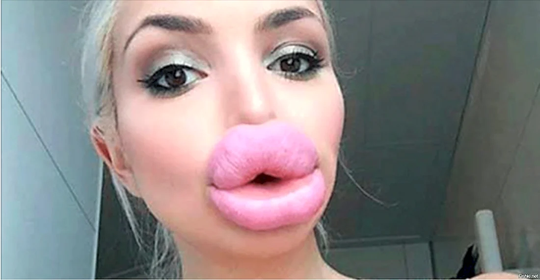 Огромные губы