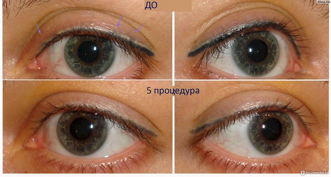 Перманентный макияж межреснички до и после