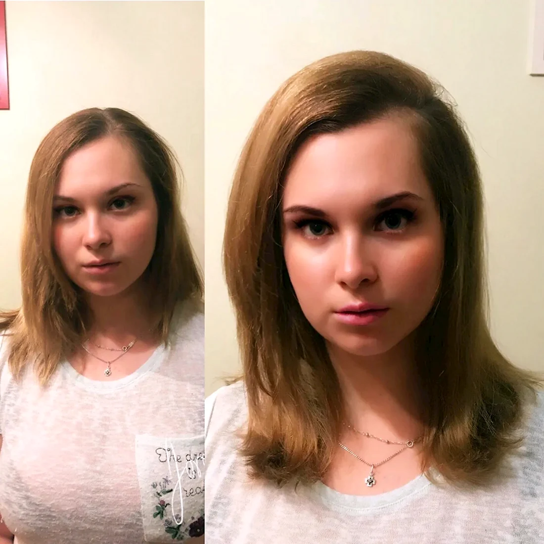Прикорневой буст ап