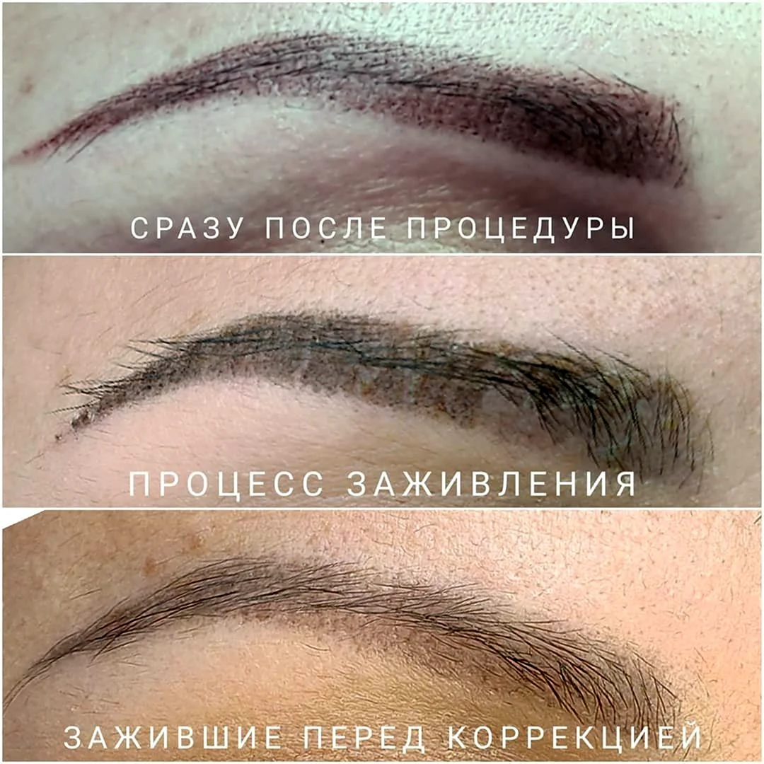 Процесс заживления перманента бровей