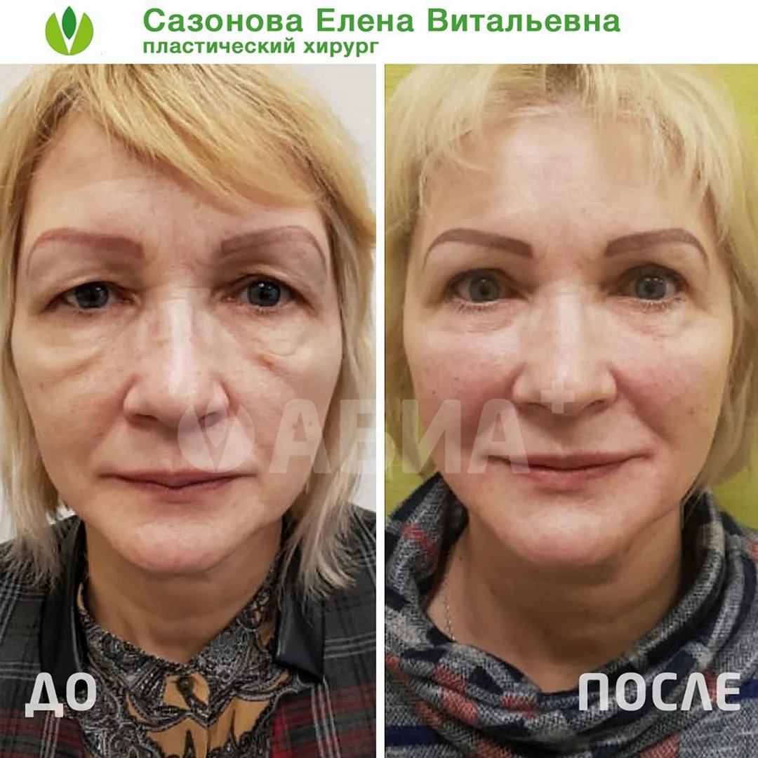 Сазонова Елена Витальевна пластический