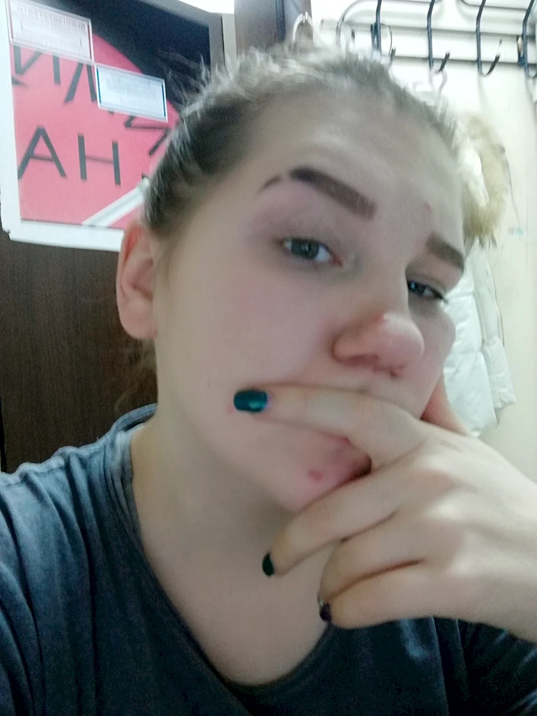Сбритая бровь
