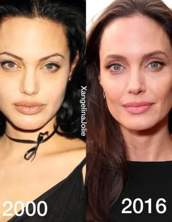 Скулы Анджелины Джоли