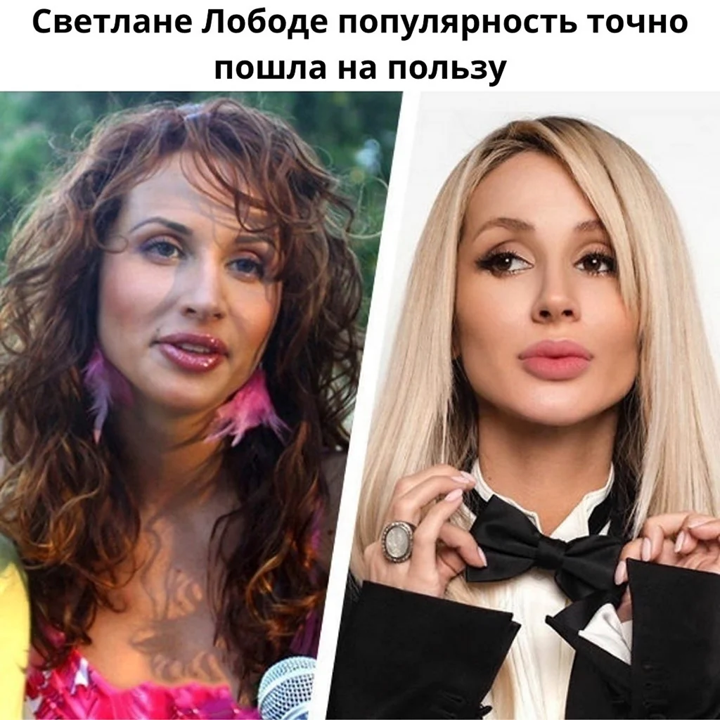 Светлана Лобода до пластики