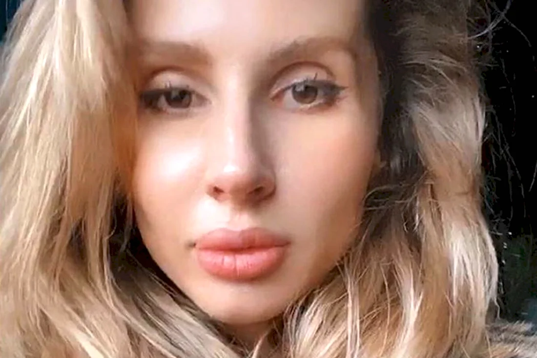 Светлана Лобода губы