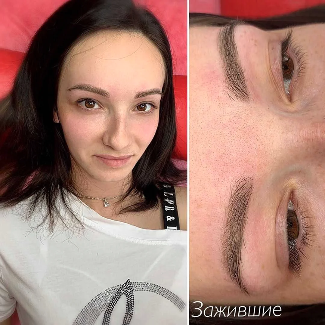 Татуаж бровей заживление