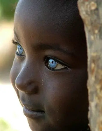 Темнокожие с голубыми глазами