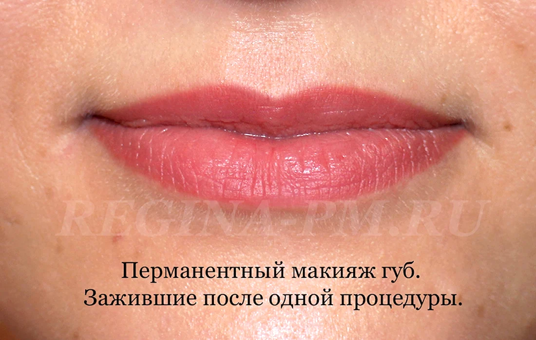 Удаление татуажа губ ремувером