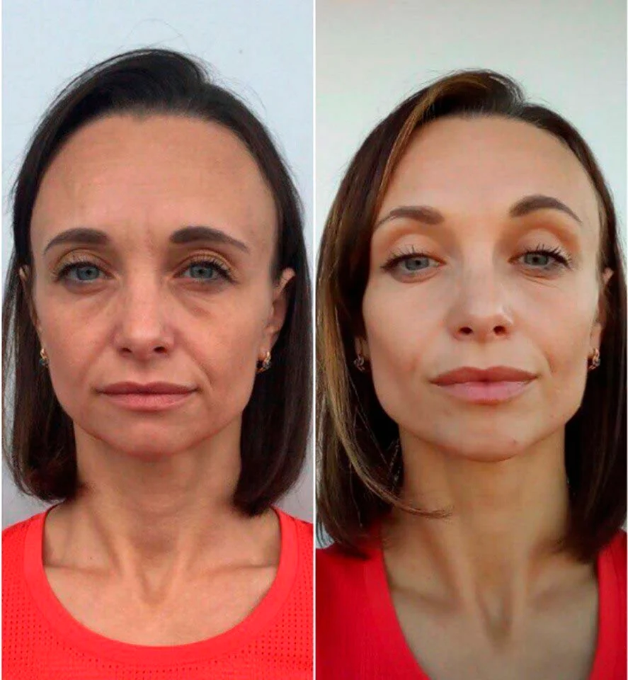 Упражнения для лица до и после