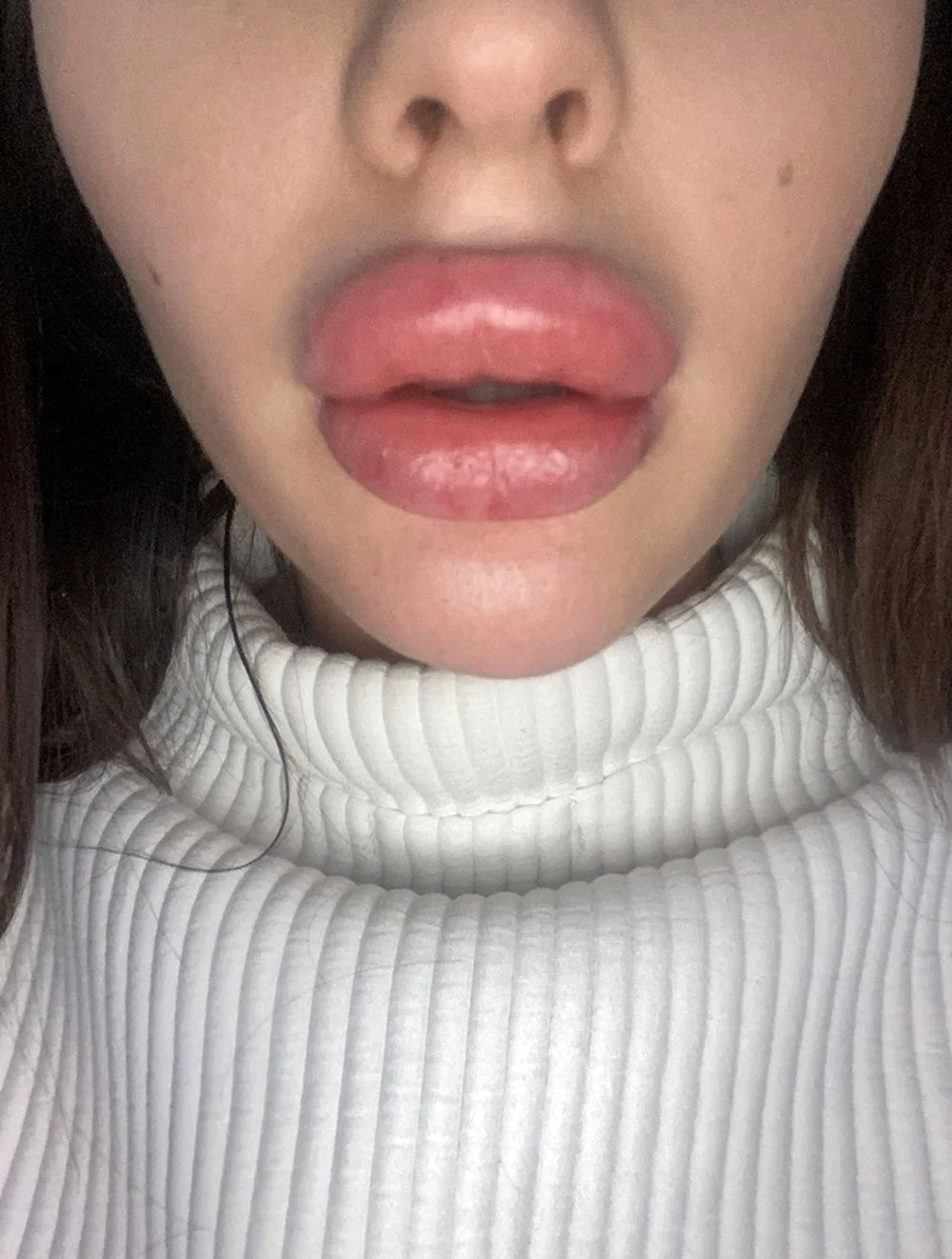 Увеличенные губы красивые