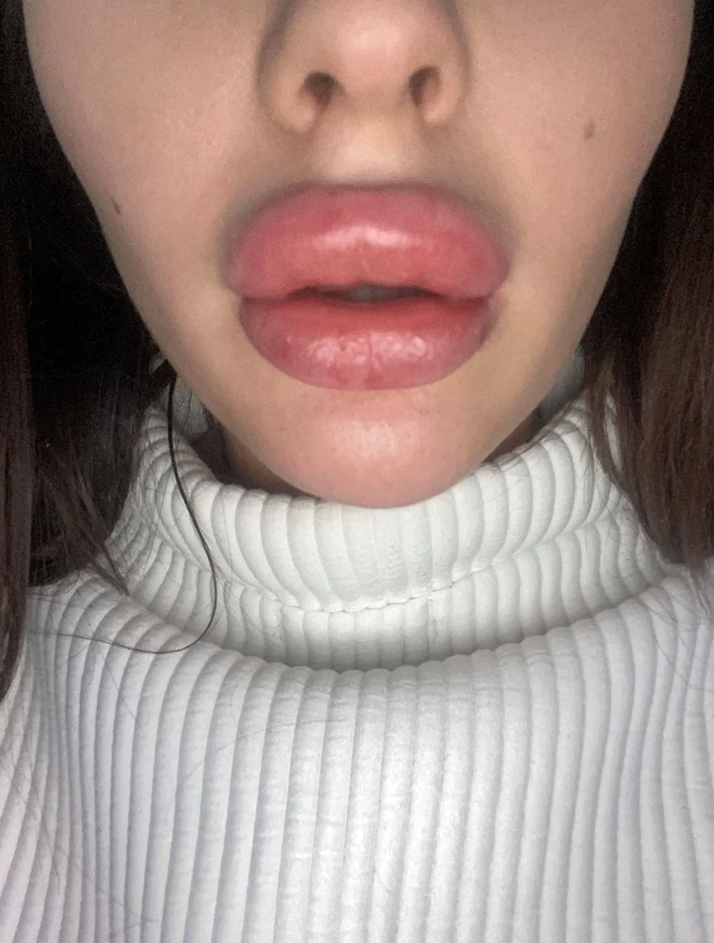 Увеличенные губы красивые