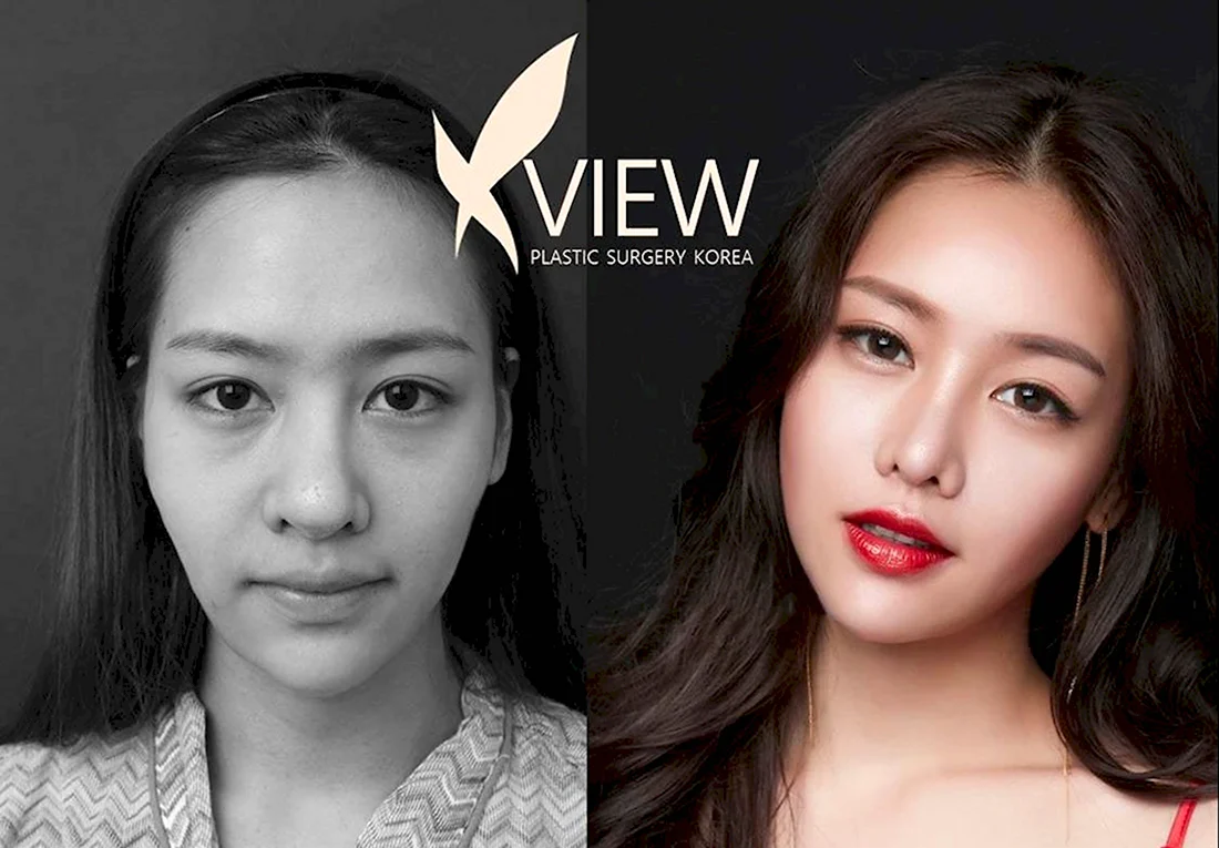 View Plastic Surgery Корея