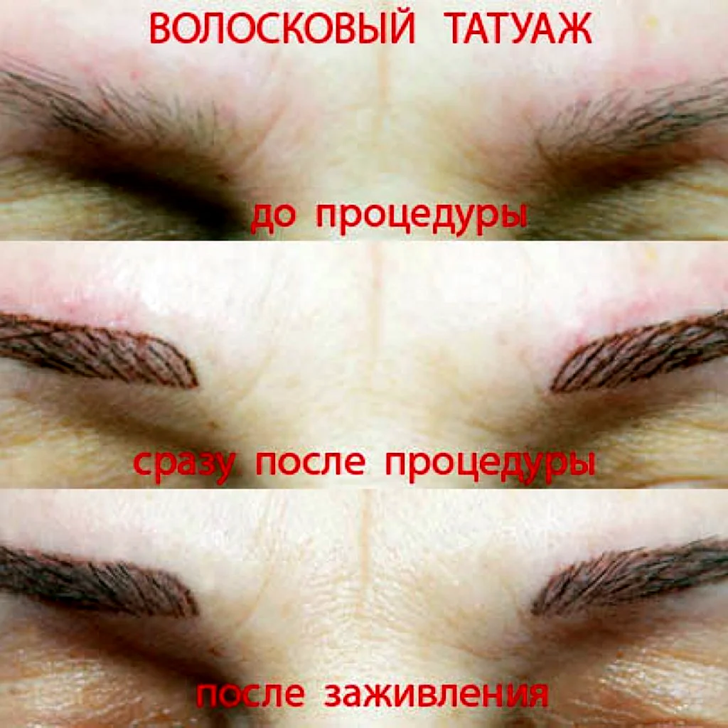 Волосковый метод бровей после заживления