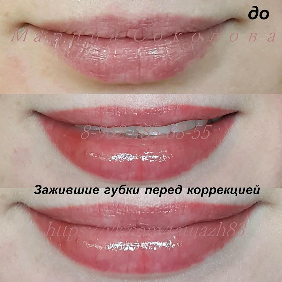 Заживление перманентного макияжа губ