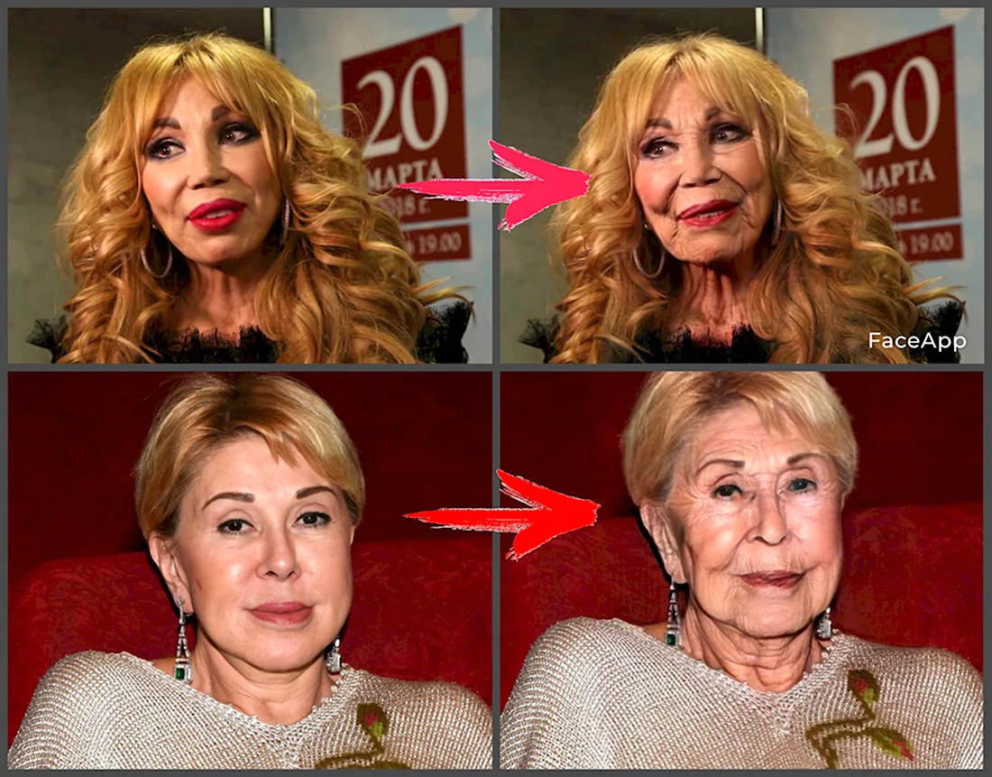 Звезды после ботокса