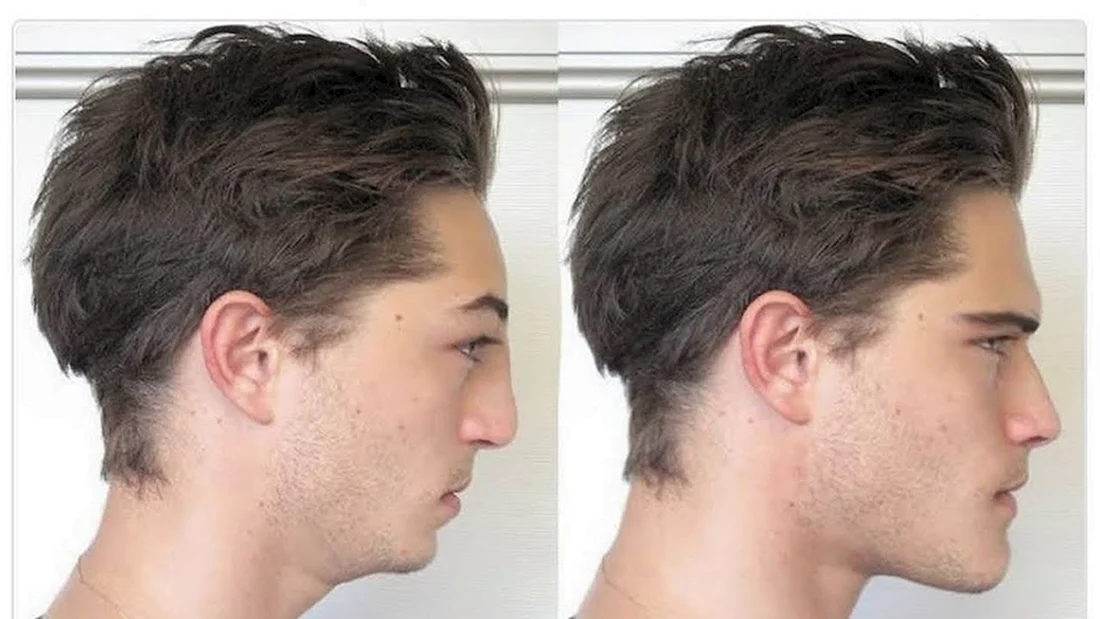 Chad incel