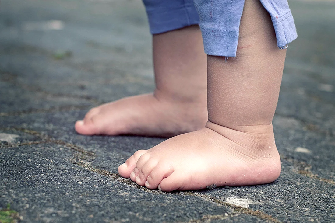 Детская нога