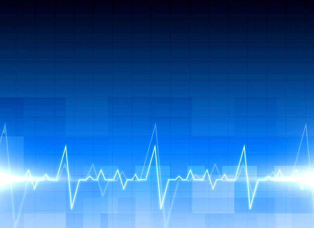 Кардиограмма