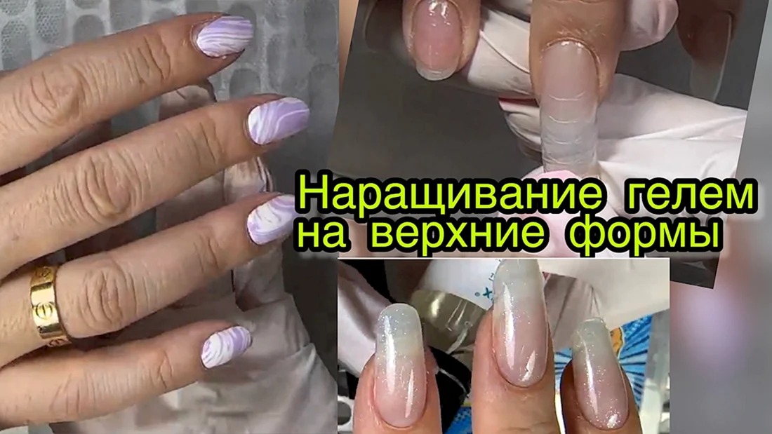 Наращивание на Верхние формы